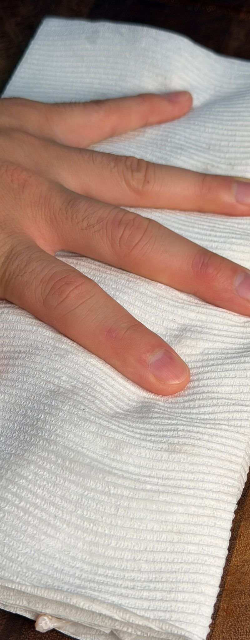 Chicken pieces being dried